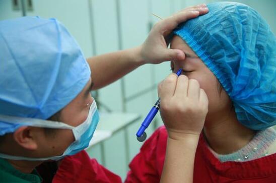 深圳陽(yáng)光醫(yī)院雙眼皮一個(gè)月恢復(fù)圖 日記見(jiàn)證蛻變