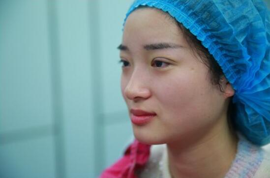 深圳陽(yáng)光醫(yī)院雙眼皮一個(gè)月恢復(fù)圖 日記見(jiàn)證蛻變