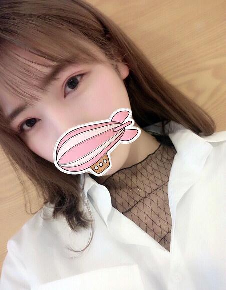 重慶五洲整形醫(yī)院醫(yī)生技術(shù)口碑|雙眼皮案例實(shí)記分享