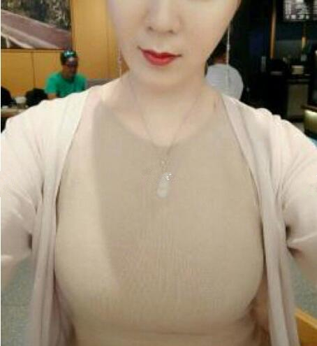 【曼托妙桃400cc水滴形假體隆胸日記——等你等得好辛苦~】