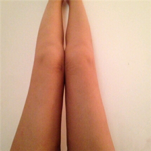 去找東方和諧馮斌做了大腿抽脂，分享一下果吧！