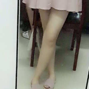 看看我大腿吸脂的恢復(fù)果圖片吧，是東方和諧王自謙做的