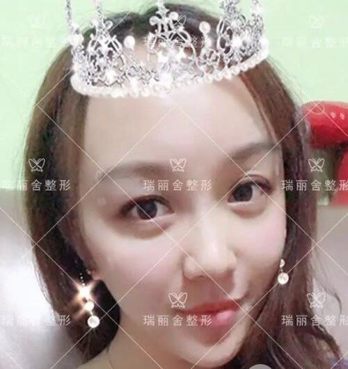 術(shù)后第一天恢復(fù)情況