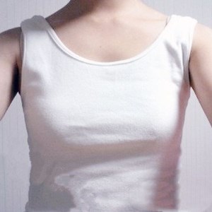 廣元美華楊林醫(yī)生做的自體脂肪隆胸，兩個(gè)月的果圖片分享~