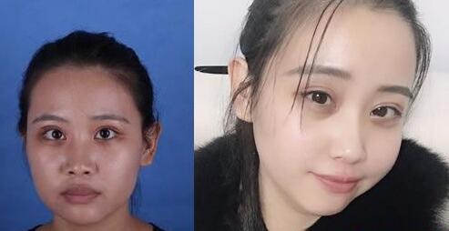 好消息!南寧華美10月20-21日邀請廖連平、劉志剛和徐艦來院坐診~