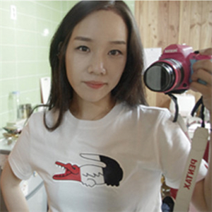 北京南加高紅霞醫(yī)生做的頭發(fā)種植，恢復(fù)得很好~