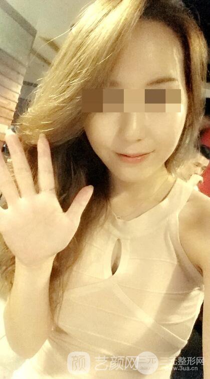 北京隆胸抽脂多少錢?北京東方和諧自體脂肪豐胸案例