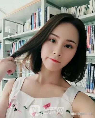 北京上上相鄭楚蓉院長自體脂肪填充全臉圖心情小記