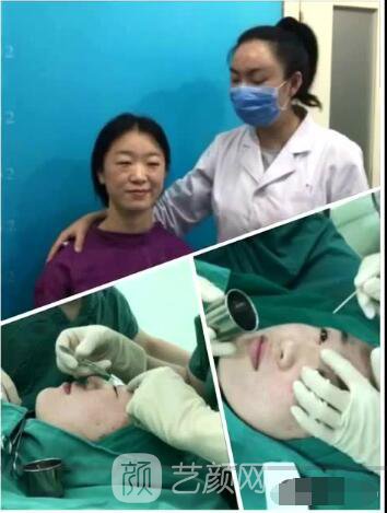 北京八大處整形布仁全切雙眼皮真實(shí)案例|圖