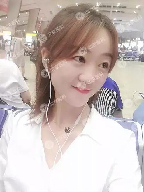 北京八大處整形布仁全切雙眼皮真實(shí)案例|圖