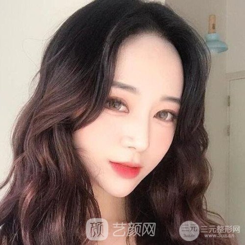 上海華美楊亞益主任做的芭比雙眼皮，果很好哦~