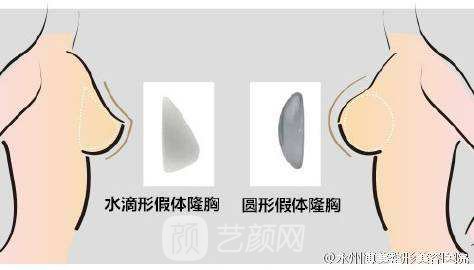 【韓式吸脂隆胸的費用多少？韓式吸脂隆胸費用的影響因素？】