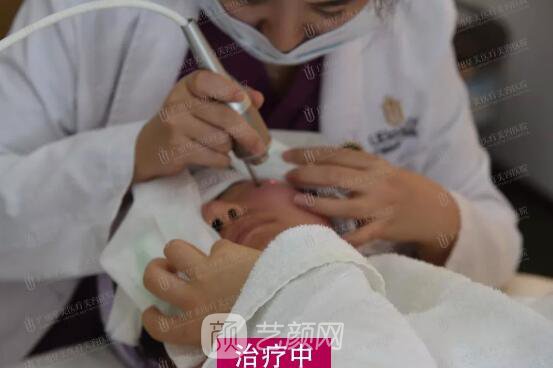 皮-秒激光祛斑案例，恢復(fù)照片分享~