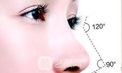 重慶微晶瓷隆鼻價格多少?微晶瓷隆鼻價格影響因素~