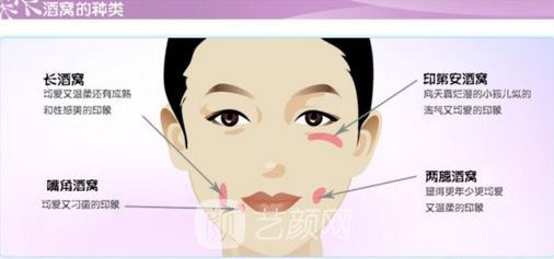 人造酒窩貴嗎？需要多少錢?