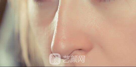 北京做修復(fù)鼻子需要多少錢?