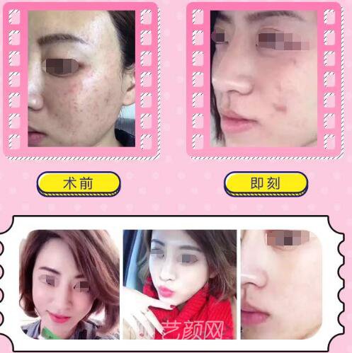 宿培龍醫(yī)生案例