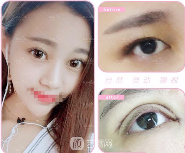 周創(chuàng)業(yè)醫(yī)生案例