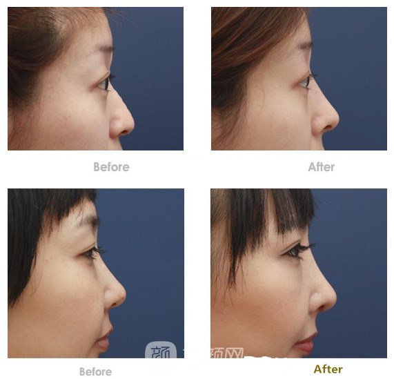 仝潤澤醫(yī)生案例