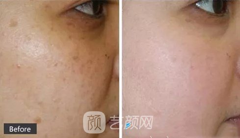 江子旭醫(yī)生案例