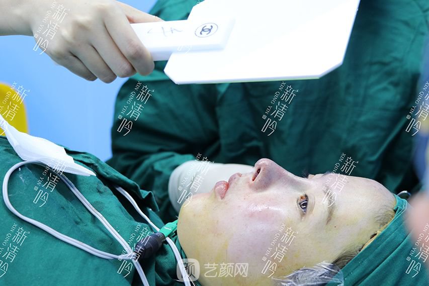 耳軟骨隆鼻果圖分享，術(shù)后~