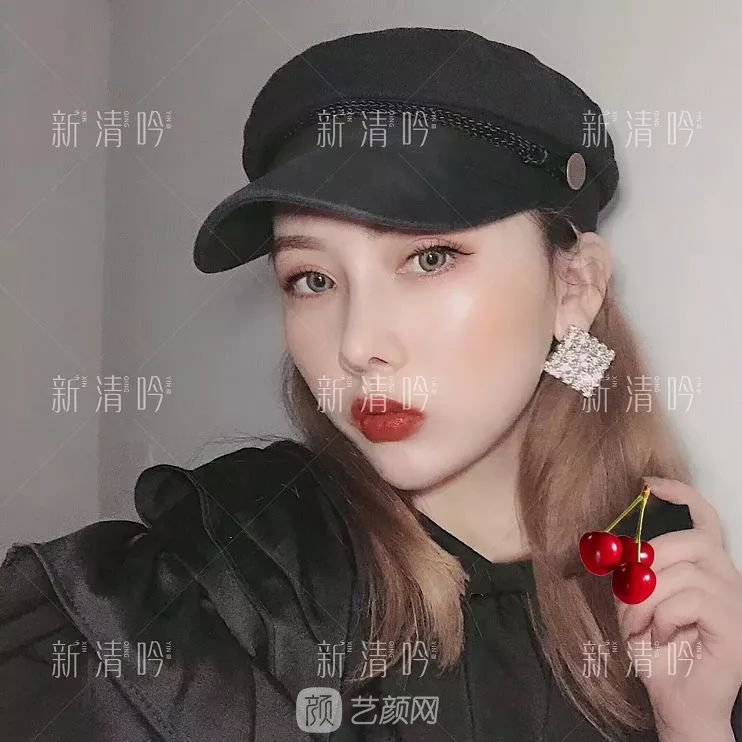 耳軟骨隆鼻果怎么樣？案例照片一覽~