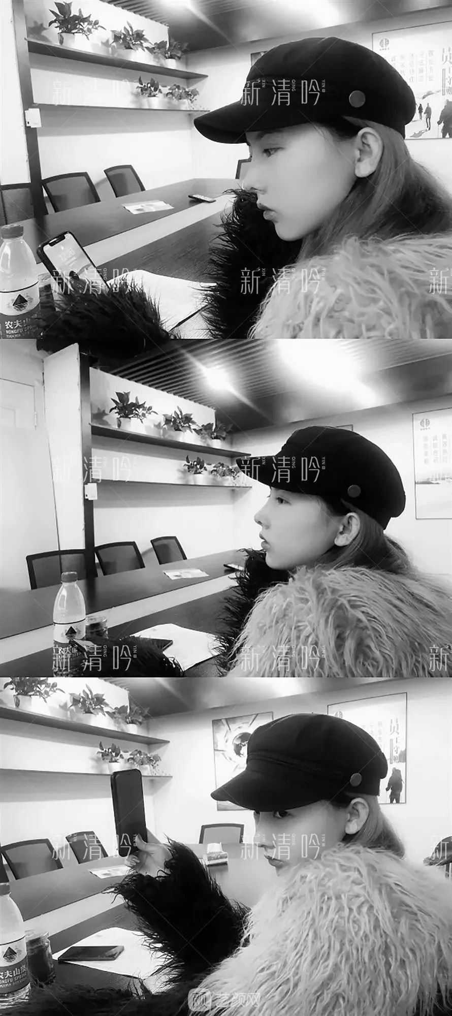 耳軟骨隆鼻果怎么樣？案例照片一覽~