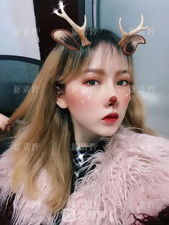 耳軟骨隆鼻果怎么樣？案例照片一覽~