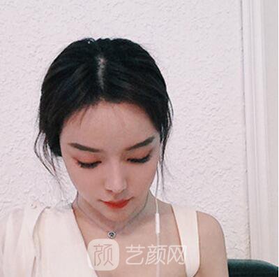 做好發(fā)際線后堪比微調(diào)的真實(shí)經(jīng)歷分享