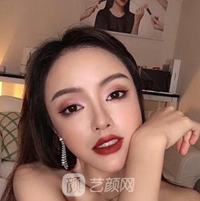 做好發(fā)際線后堪比微調(diào)的真實(shí)經(jīng)歷分享