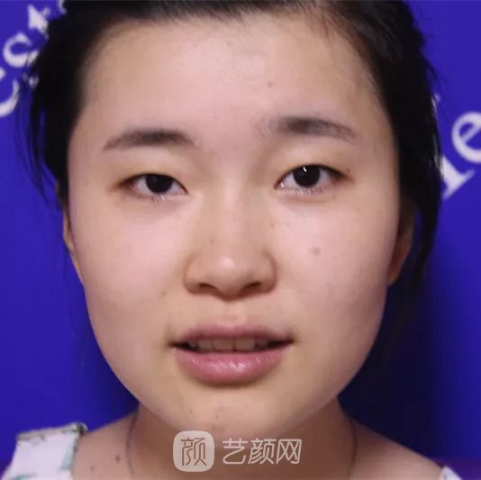 出道三年，她整成這樣終于亮相芒果臺(tái)啦！