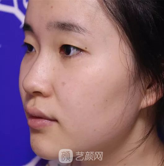 出道三年，她整成這樣終于亮相芒果臺(tái)啦！