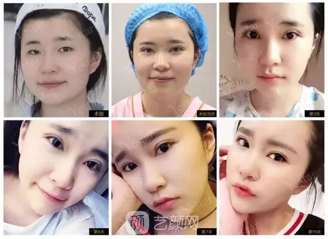 出道三年，她整成這樣終于亮相芒果臺(tái)啦！