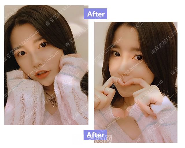 出道三年，她整成這樣終于亮相芒果臺(tái)啦！