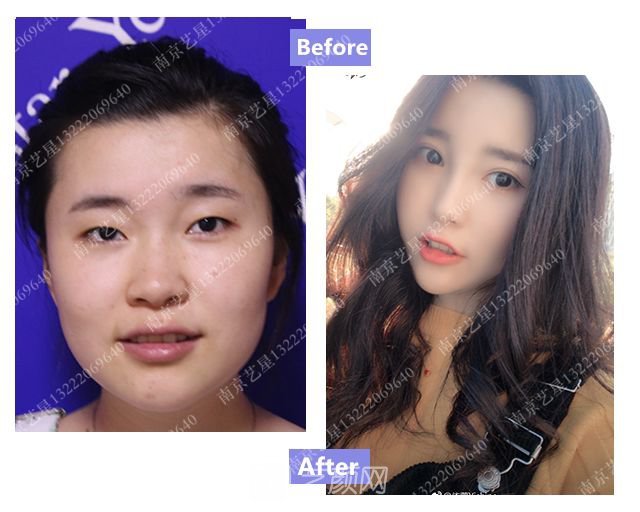 出道三年，她整成這樣終于亮相芒果臺(tái)啦！