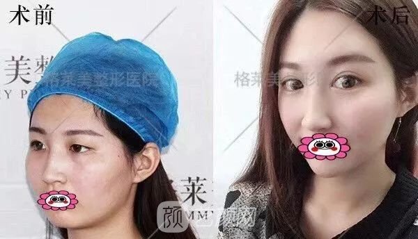 福州格萊美跨年造美節(jié)開始啦，四重好禮送不停，5人同行項目5折起~