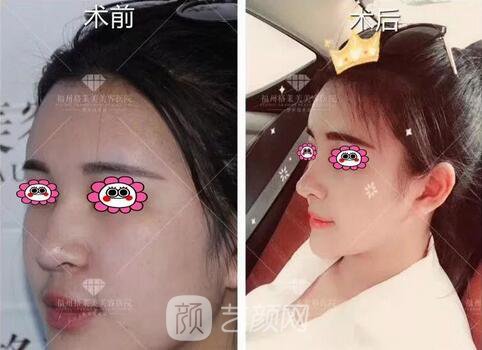 福州格萊美跨年造美節(jié)開始啦，四重好禮送不停，5人同行項目5折起~