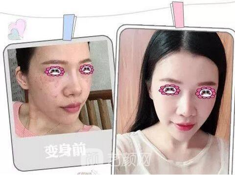 福州格萊美跨年造美節(jié)開始啦，四重好禮送不停，5人同行項目5折起~