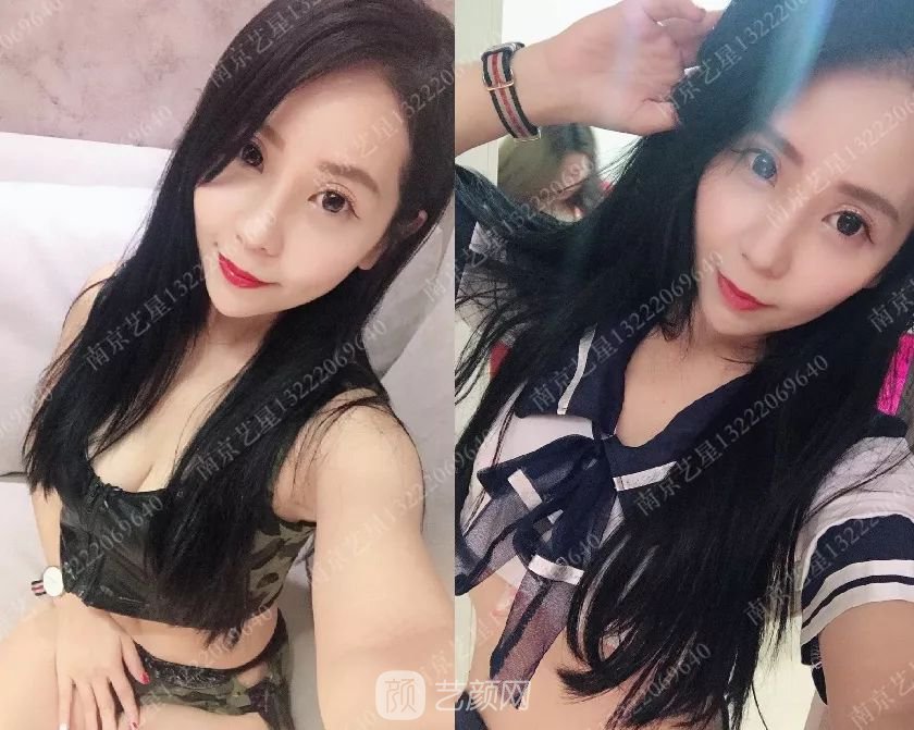 只需要5分鐘，我的鼻子變高了！——南京藝星玻尿酸隆鼻~