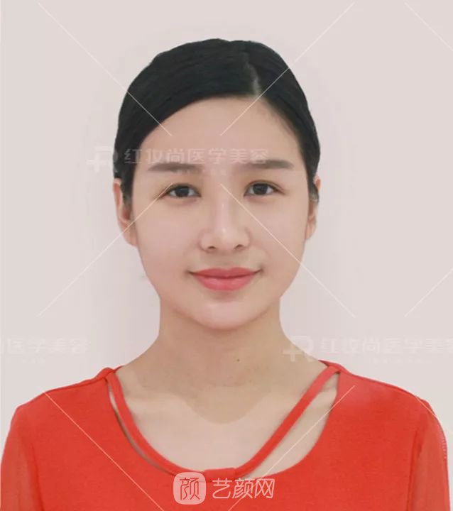 【蛻變?nèi)沼洝拷^美側(cè)顏的秘密——分享我的美鼻之旅~