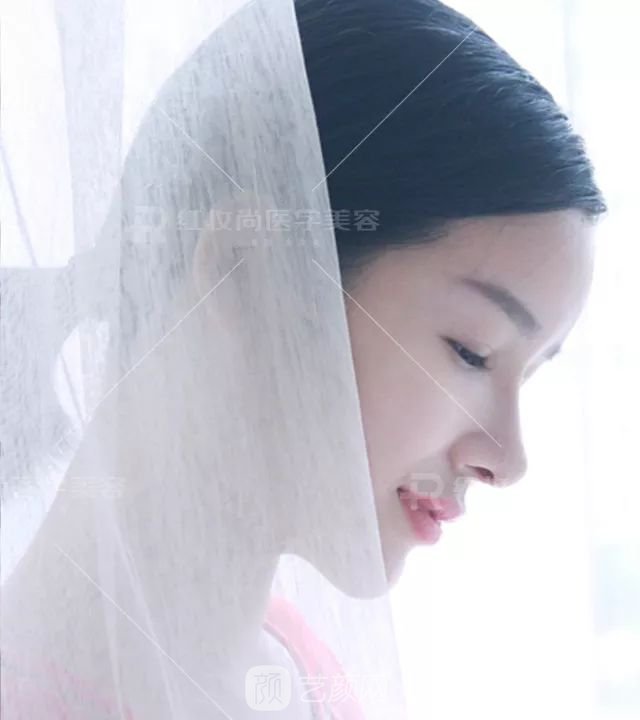 【蛻變?nèi)沼洝拷^美側(cè)顏的秘密——分享我的美鼻之旅~