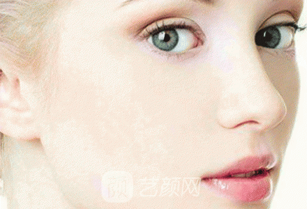 全身美白的價格大概要多少錢?