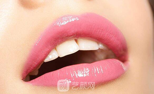 漂唇手術(shù)后會(huì)需要注意哪些事項(xiàng)?