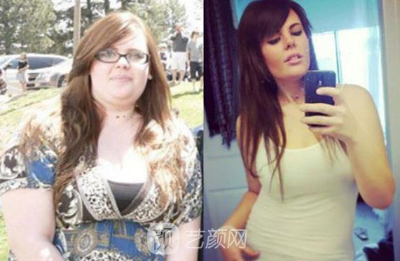 美國(guó)立秀減肥溶脂素