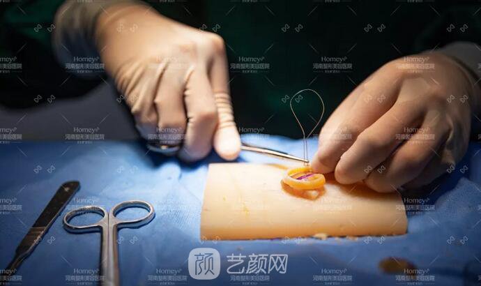 【取肋軟骨會影響孩子胸廓發(fā)育嗎？】