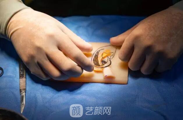 【再造的耳朵軟硬度摸起來和正常耳朵一樣嗎？】