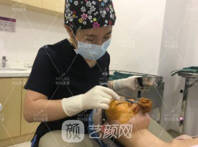 面部下垂怎么改良，埋線提升提升真實案例