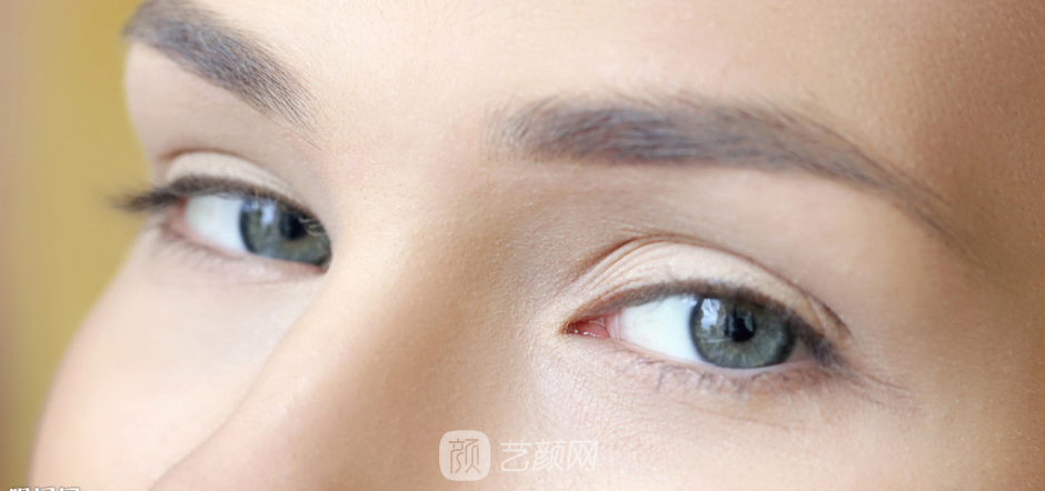 雙眼皮要怎么割，才能別人才看不出來