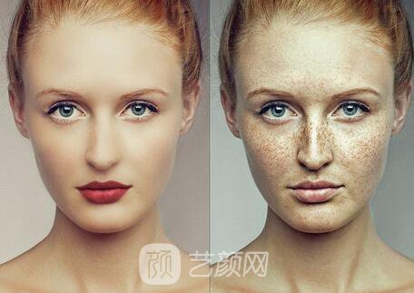 調(diào)節(jié)黃褐斑是長(zhǎng)期的工程，需要堅(jiān)持才能見果