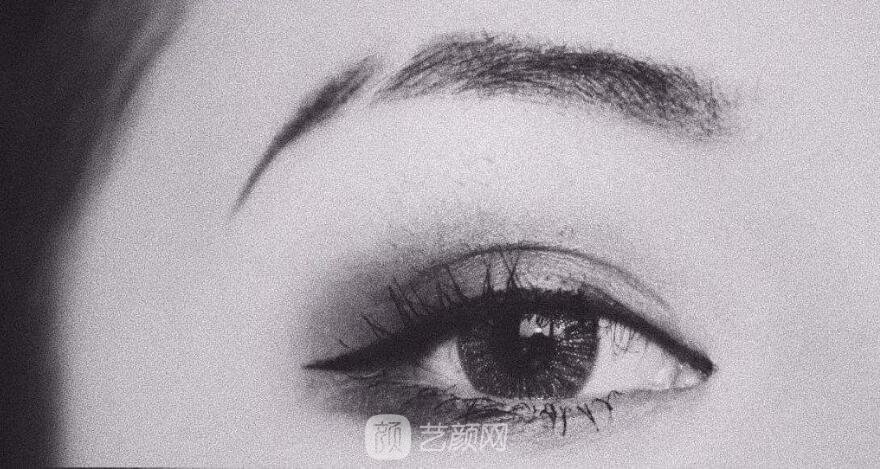 全飛秒手術(shù)與其它近視激光手術(shù)區(qū)別在哪些地方